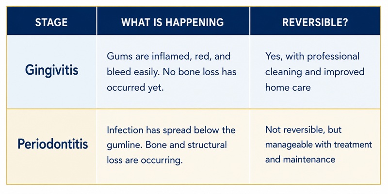 Table showing the different types of gum disease, gingivitis and periodontitis.