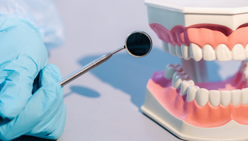 Dentist holding a dental mirror beside a tooth model while explaining restorative options like cosmetic bonding and crowns.