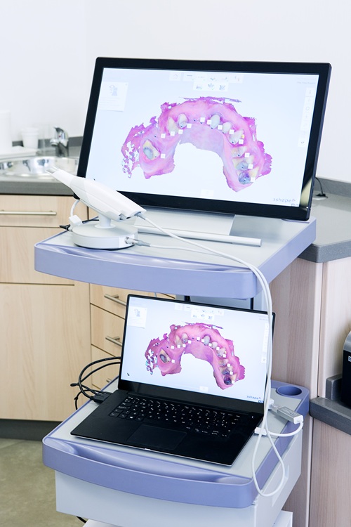 An intraoral scanner used for dental procedures. 